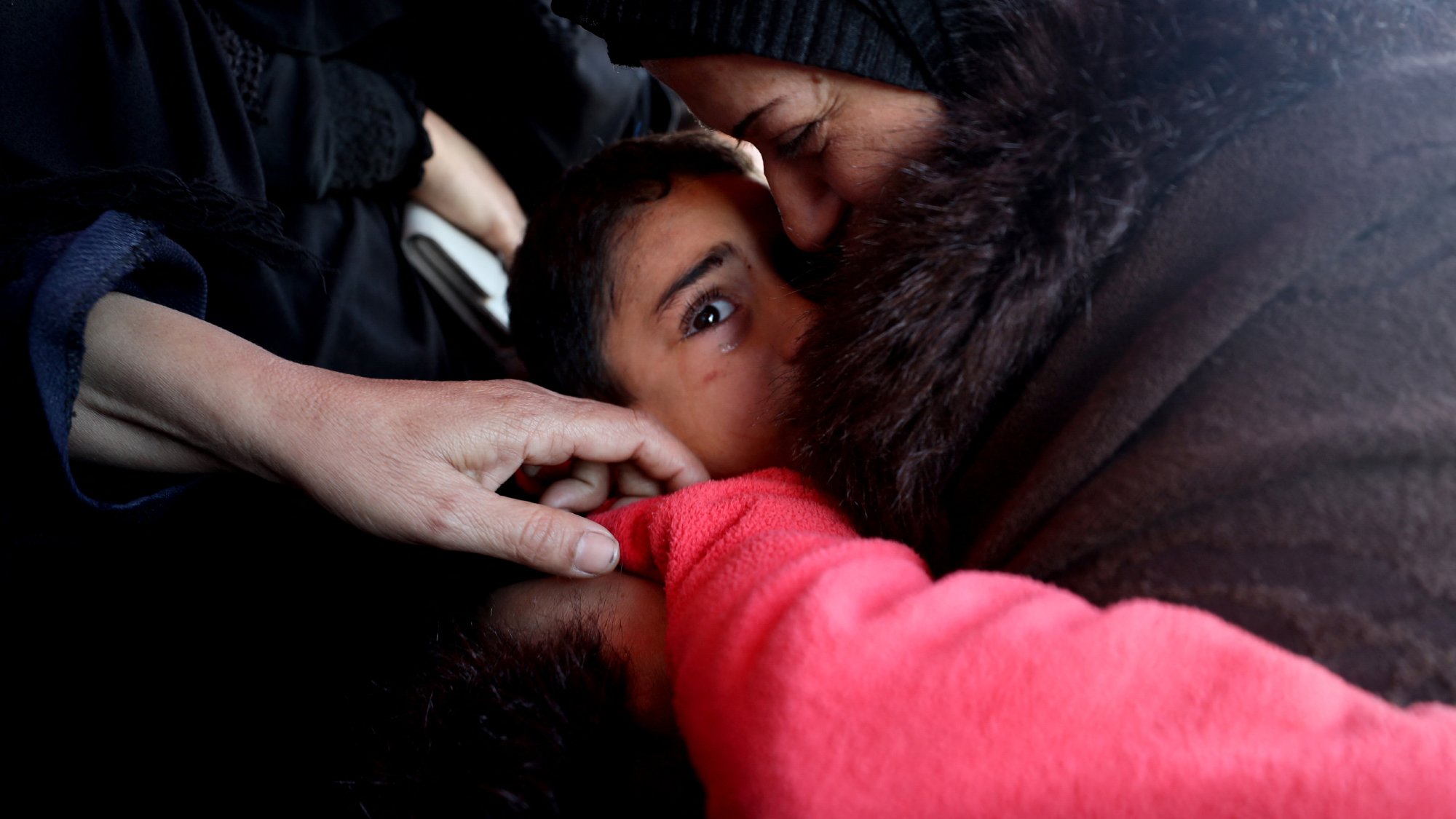 The image depicts a close interaction between an adult woman and a child. The woman is gently kissing the child on the forehead, while the child looks directly at the camera with a serious expression. There are hands visible in the foreground, suggesting that others are present nearby. The overall atmosphere conveys a sense of warmth and tenderness despite the child's intense gaze. The setting appears to be intimate, possibly capturing a moment of care and connection in a challenging situation.