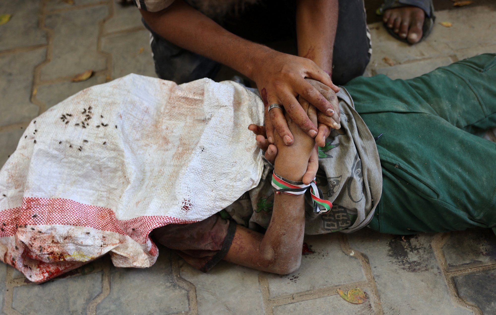 Un bambino ferito, giace a terra, mentre un adulto lo sostiene con affetto.