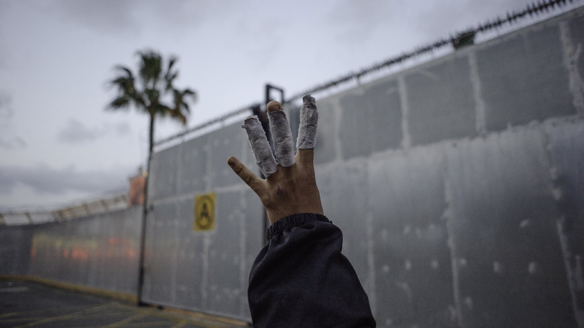 L'image montre une main levée avec des bandages enroulés autour de plusieurs doigts. En arrière-plan, on peut apercevoir un mur en métal, probablement une clôture ou une barrière, ainsi qu'un ciel nuageux. Une palme est visible à gauche, suggérant un environnement urbain. L'atmosphère semble un peu sombre et mystérieuse.