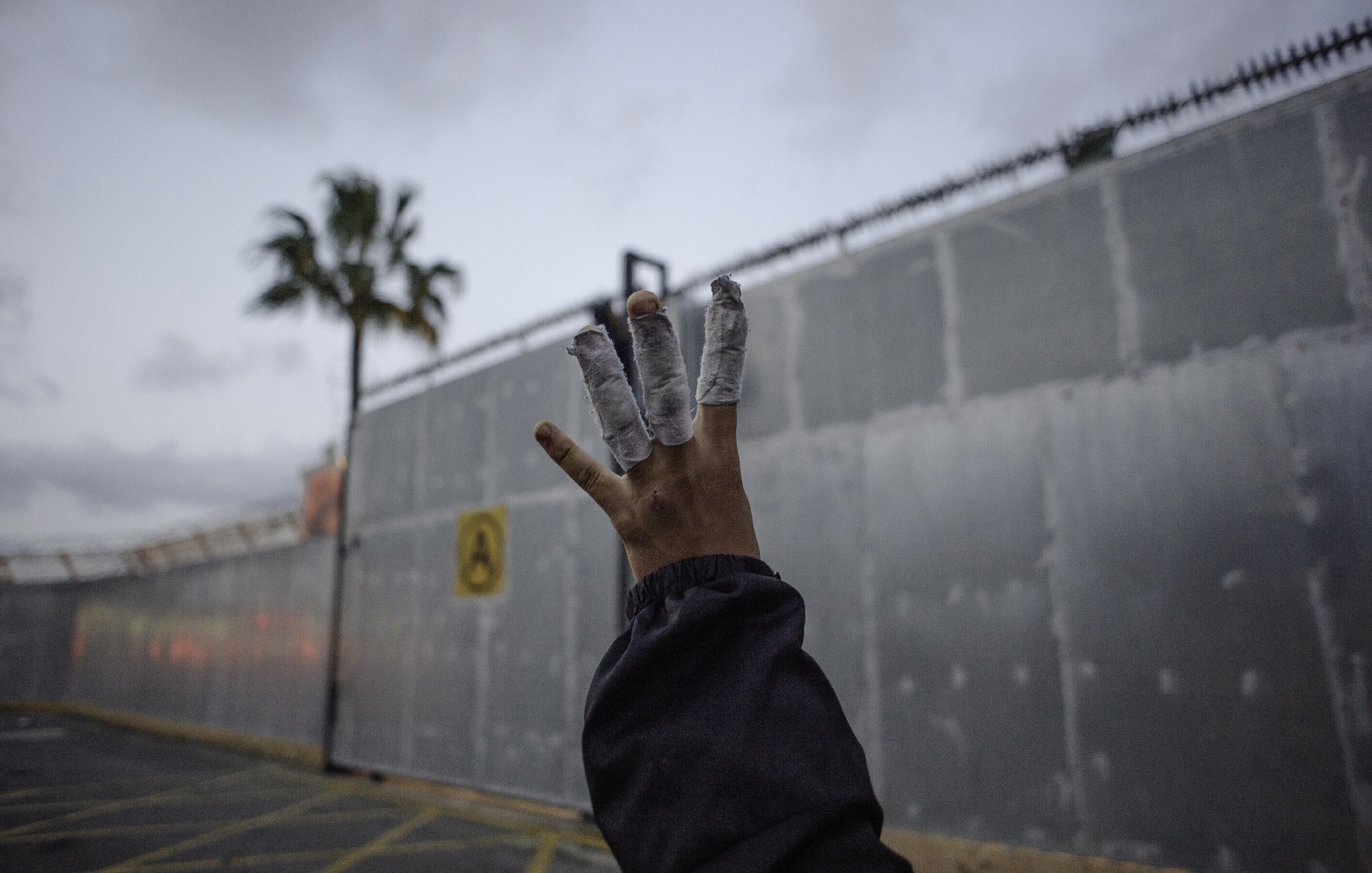 L'image montre une main levée avec des bandages enroulés autour de plusieurs doigts. En arrière-plan, on peut apercevoir un mur en métal, probablement une clôture ou une barrière, ainsi qu'un ciel nuageux. Une palme est visible à gauche, suggérant un environnement urbain. L'atmosphère semble un peu sombre et mystérieuse.