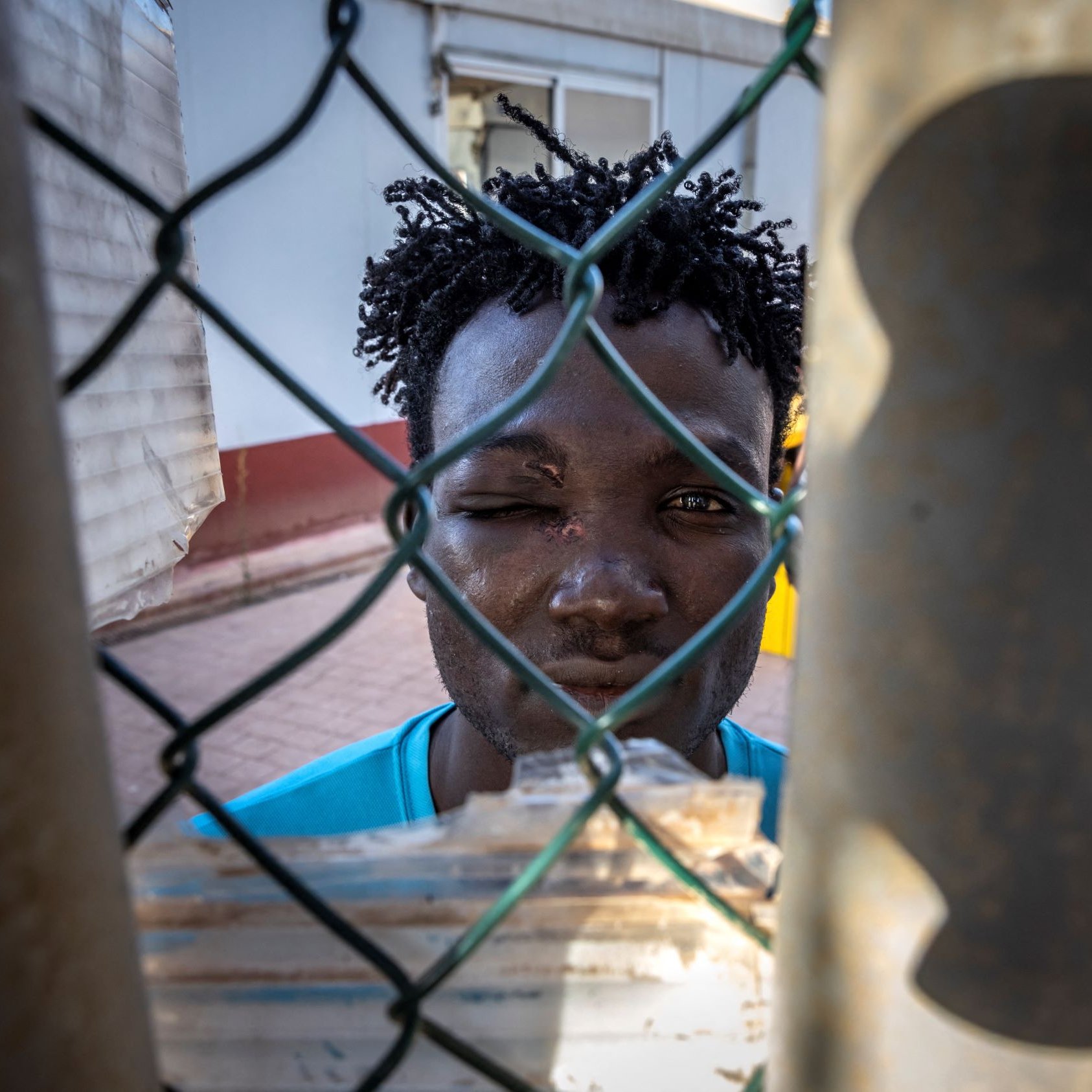 در این تصویر، جوانی با موهای مجعد و تیره در پشت یک حصار مشبک دیده می‌شود. چهره‌اش از طریق شبکه‌های فلزی حصار قابل مشاهده است و به نظر می‌رسد که یکی از چشمانش کمی متورم است. جوان در یک محیط شهری قرار دارد و لباس آبی روشنی به تن دارد. احساسات او در چهره‌اش مشهود است و فضای تصویر با نور طبیعی روشن شده است.