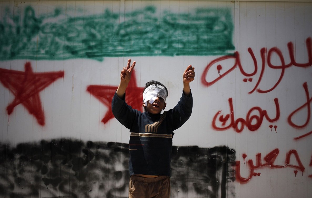 تظهر الصورة صبيًا صغيرًا يرفع يديه بإشارات النصر، بينما يغطّي عينيه برباط أبيض. خلفه جدار مطلي عليه رسم يمثل علم سوريا، مع كلمات مكتوبة بالعربية تظهر اعتراضًا أو دعماً لموضوع معين. تعكس الصورة مشاعر الأمل والعزيمة في وجه الصعوبات.