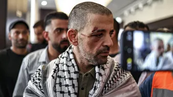مردی با جراحت روی صورت و شال فلسطینی، در حال صحبت با جمعیتی در پس‌زمینه.