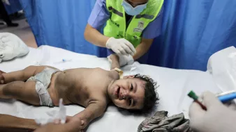 در این تصویر، یک کودک خردسال در حال معاینه پزشکی قرار دارد. کودک به شکم دراز کشیده و لبخند میزند، در حالی که دستهای پزشک یا پرستار در حال ارائه درمان یا رسیدگی به او است. محیط بیمارستانی به وضوح دیده میشود و پسزمینه شامل پردههایی است که حریم خصوصی را حفظ میکنند. وضعیت کودک به نظر نیاز به مراقبت پزشکی دارد.