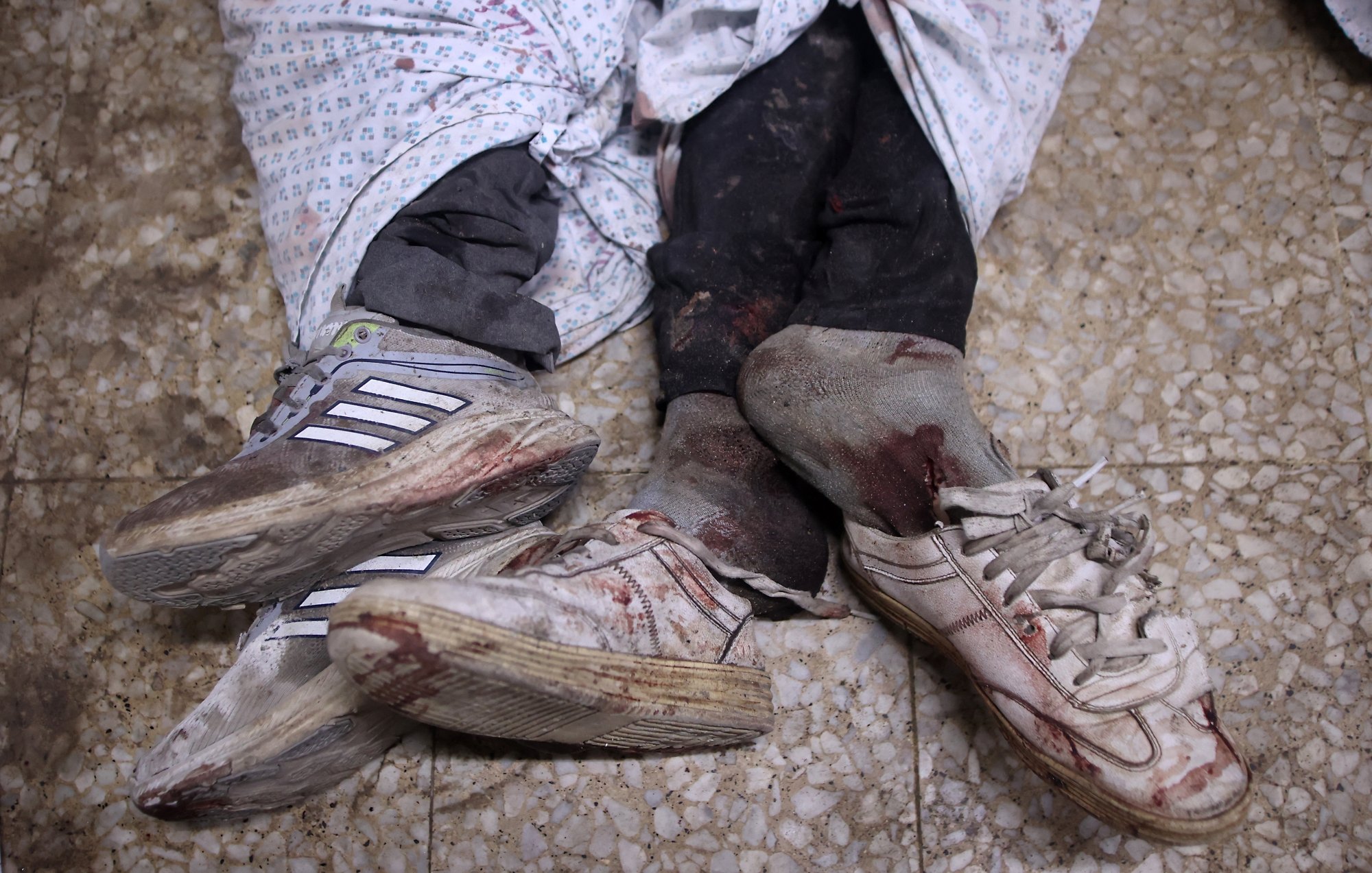 Deux pieds ensanglantés portant des chaussures, enveloppés dans des draps.