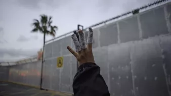 L'image montre une main levée avec des bandages enroulés autour de plusieurs doigts. En arrière-plan, on peut apercevoir un mur en métal, probablement une clôture ou une barrière, ainsi qu'un ciel nuageux. Une palme est visible à gauche, suggérant un environnement urbain. L'atmosphère semble un peu sombre et mystérieuse.