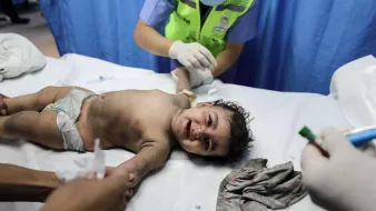 L'image montre un bébé allongé sur une table d'examen médical. L'enfant semble être en cours de traitement, entouré de personnel médical qui lui porte attention. Il est vêtu d'une couche et a un air triste, tout en étant manipulé avec précaution. Le décor est celui d'un hôpital, avec des rideaux bleus en arrière-plan. Des instruments médicaux peuvent être visibles autour de lui.