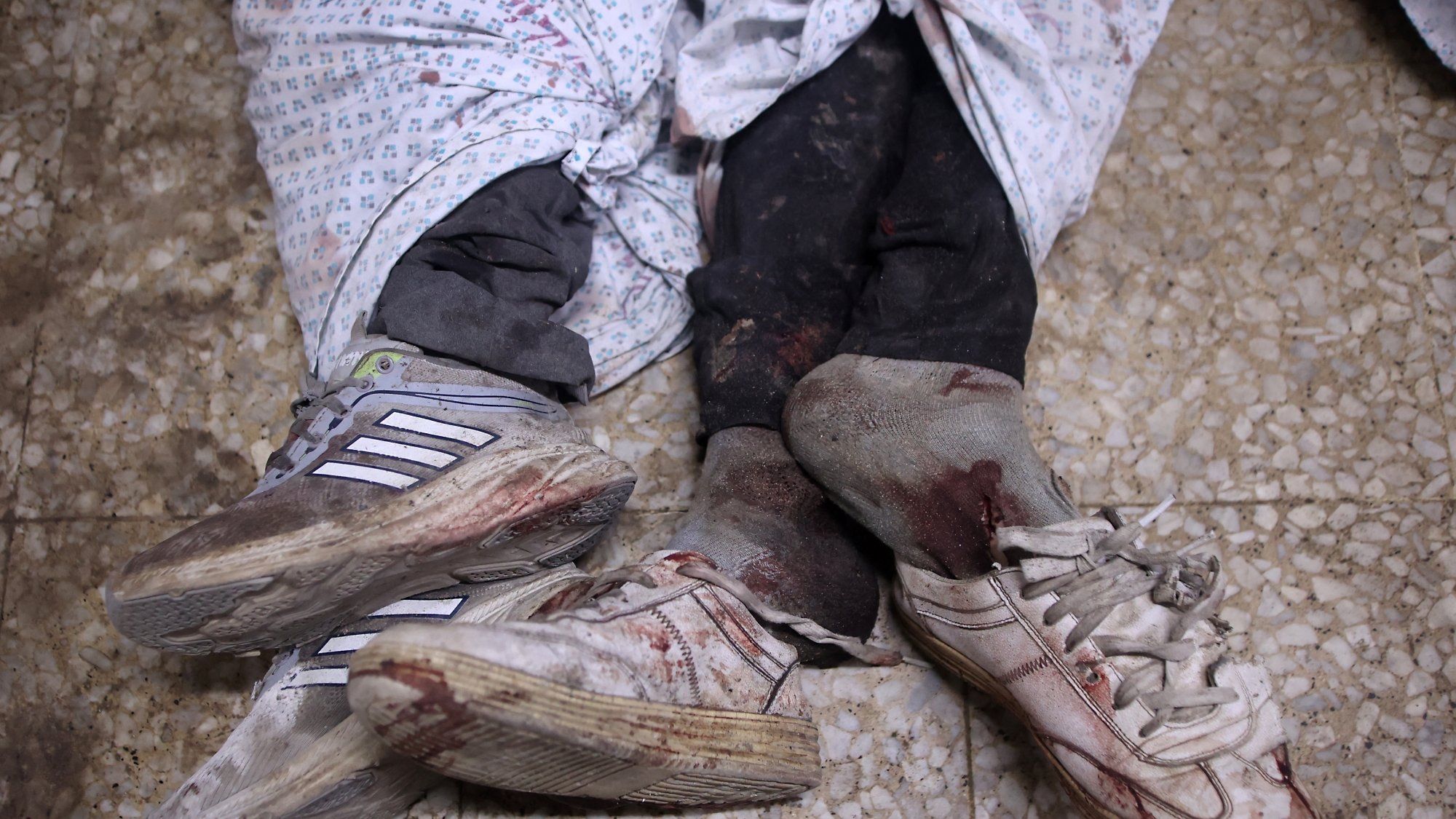 Due paia di scarpe sporche di sangue, avvolte in lenzuola macchiate.