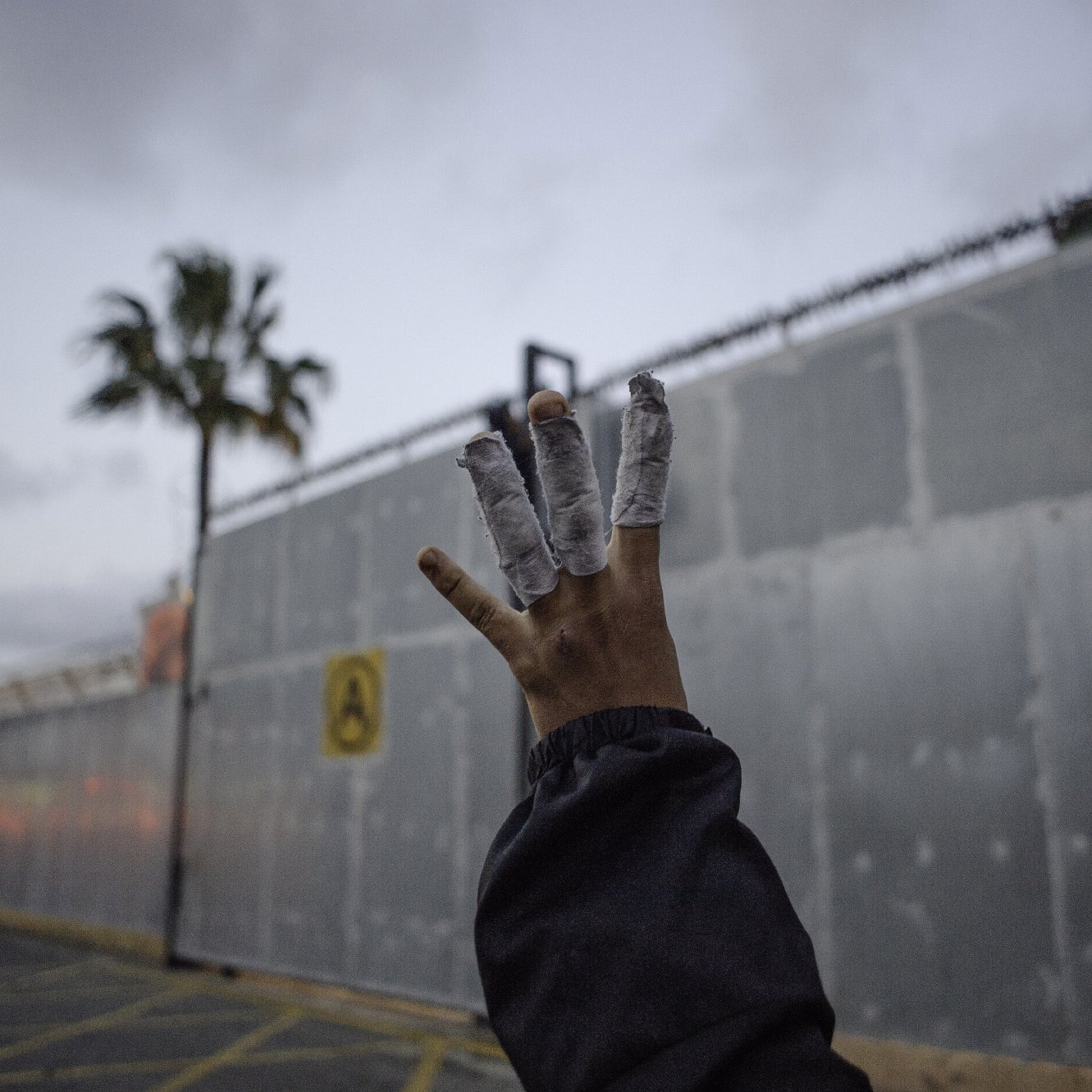 L'image montre une main levée avec des bandages enroulés autour de plusieurs doigts. En arrière-plan, on peut apercevoir un mur en métal, probablement une clôture ou une barrière, ainsi qu'un ciel nuageux. Une palme est visible à gauche, suggérant un environnement urbain. L'atmosphère semble un peu sombre et mystérieuse.