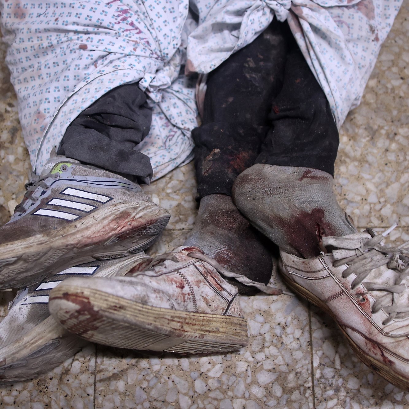 Deux pieds ensanglantés portant des chaussures, enveloppés dans des draps.