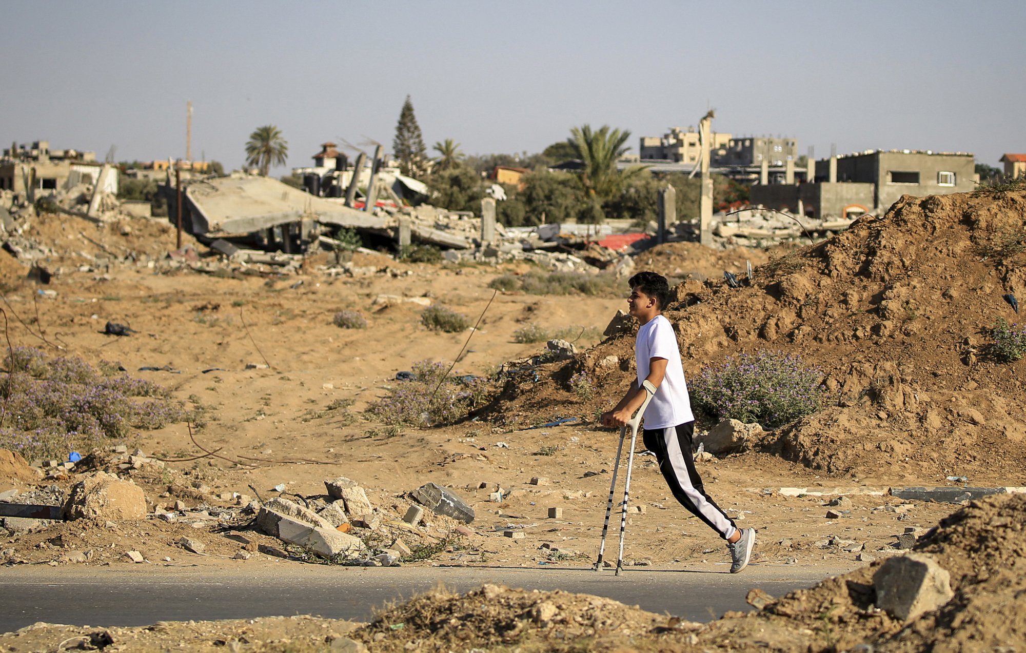 در این تصویر، پسری جوان با عصا در حال راه رفتن در میان ویرانه‌ها و خرابی‌های یک منطقه است. در پس‌زمینه، ساختمان‌های تخریب‌شده و نواحی خشک و بی‌حالت دیده می‌شوند. وجود برخی درختان و گیاهان در اطراف به تصویر حس زندگی و امید می‌دهد، اما وضعیت کلی محیط نشان‌دهنده آسیب و فاجعه است. آسمان آبی و صاف به تضاد با زمین ویران شده می‌افزاید.
