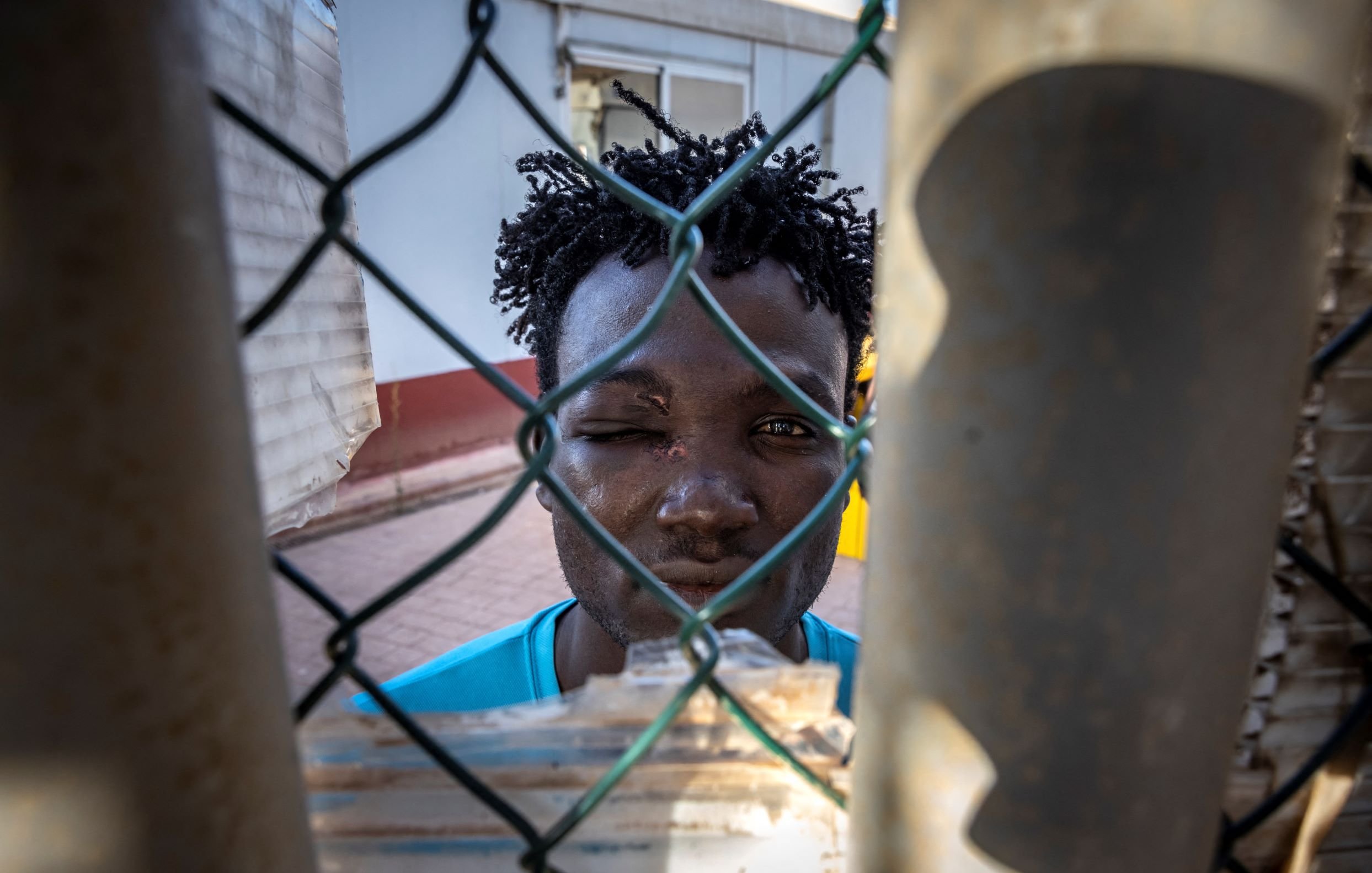 در این تصویر، جوانی با موهای مجعد و تیره در پشت یک حصار مشبک دیده می‌شود. چهره‌اش از طریق شبکه‌های فلزی حصار قابل مشاهده است و به نظر می‌رسد که یکی از چشمانش کمی متورم است. جوان در یک محیط شهری قرار دارد و لباس آبی روشنی به تن دارد. احساسات او در چهره‌اش مشهود است و فضای تصویر با نور طبیعی روشن شده است.