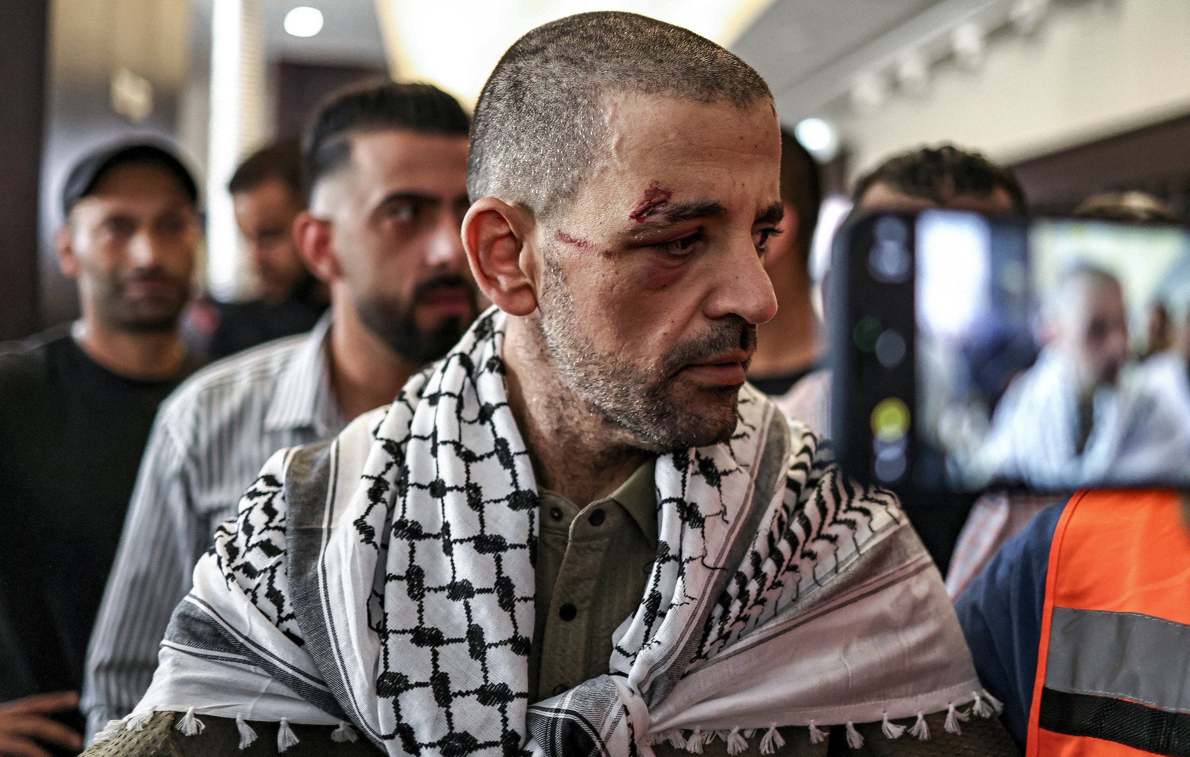 Un uomo con un fazzoletto palestinese, visibilmente colpito, circondato da altre persone.