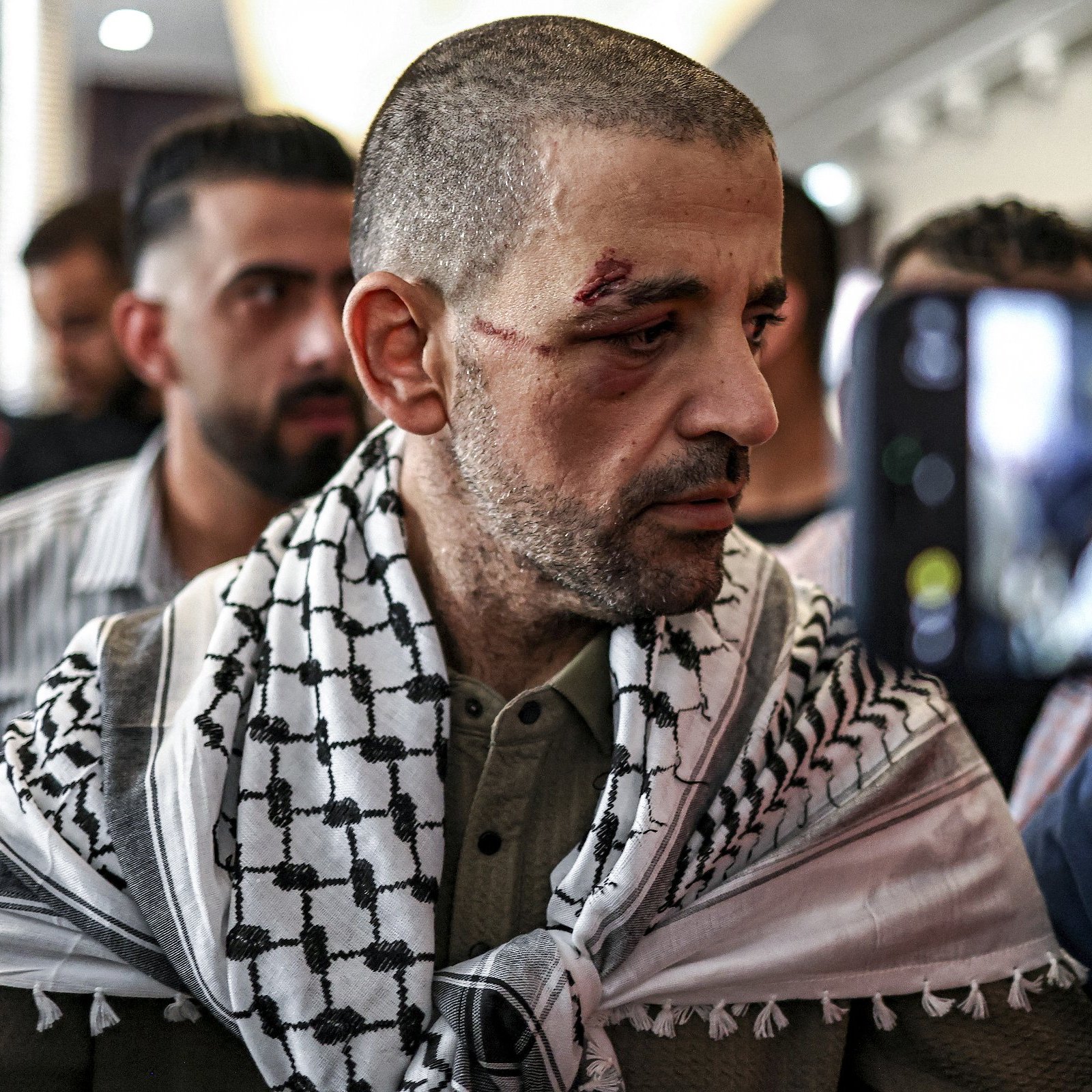 Homme blessé, portant un keffieh, entouré de personnes, visage marqué par une blessure.