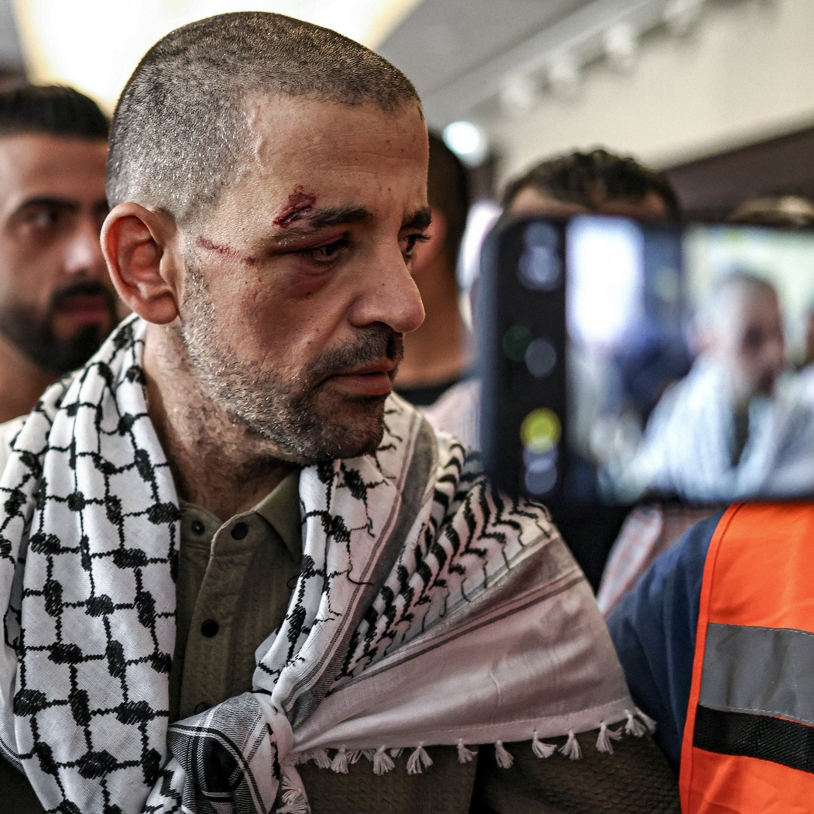 مردی با جراحت روی صورت و شال فلسطینی، در حال صحبت با جمعیتی در پس‌زمینه.