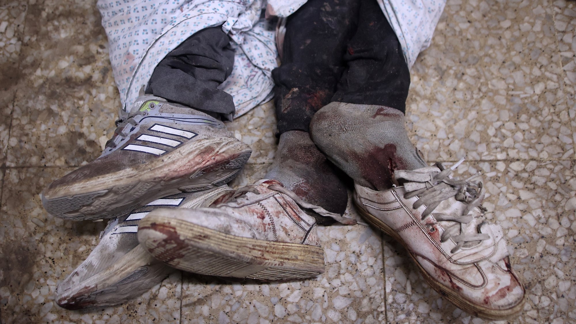 Deux pieds ensanglantés portant des chaussures, enveloppés dans des draps.