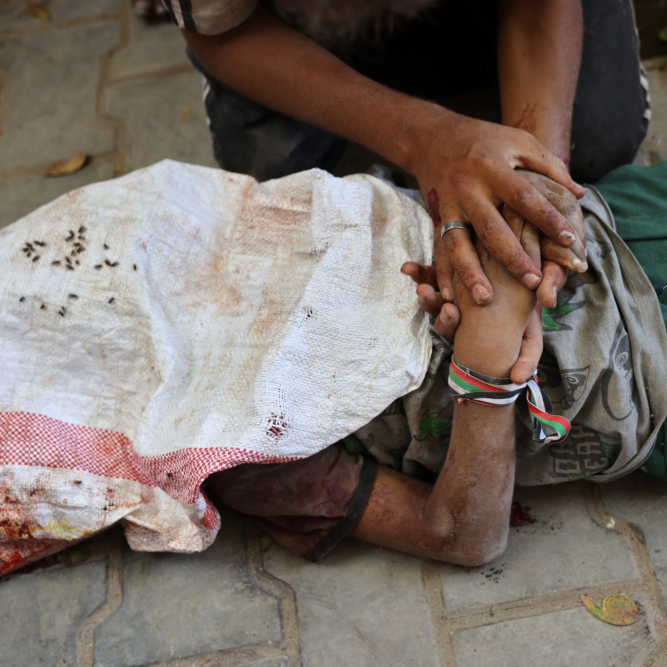 Un bambino ferito, giace a terra, mentre un adulto lo sostiene con affetto.