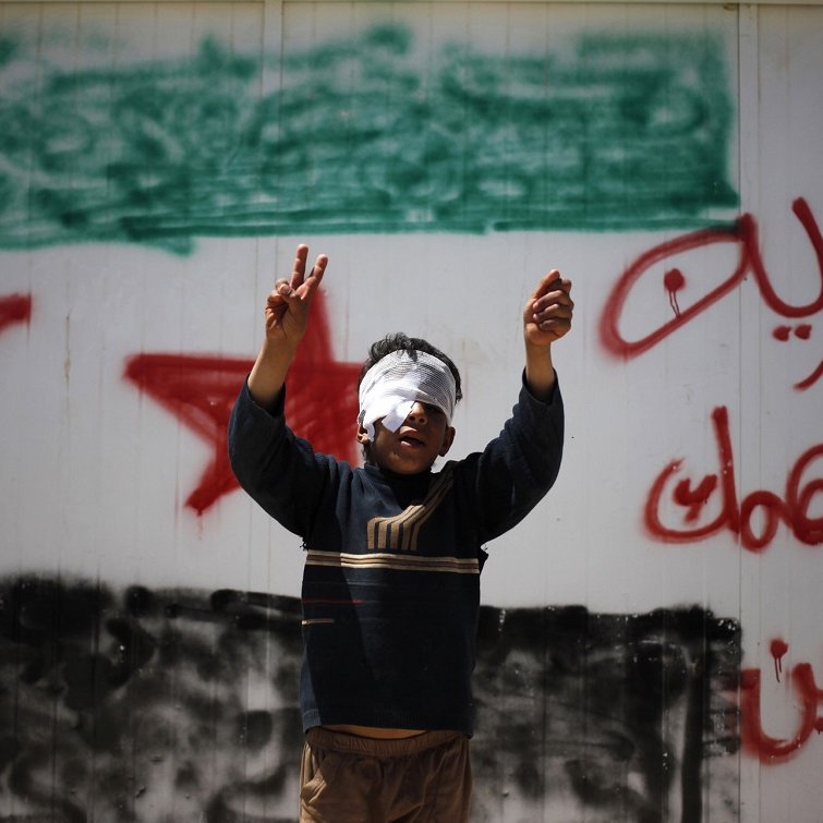 L'image montre un jeune garçon, les yeux bandés, levant les bras en signe de victoire ou de protestation. Il se trouve devant un mur sur lequel sont inscrits des slogans en arabe, ainsi qu'un symbole représentant le drapeau syrien. Cette scène évoque des thèmes de résistance et de luttes dans un contexte de conflit.