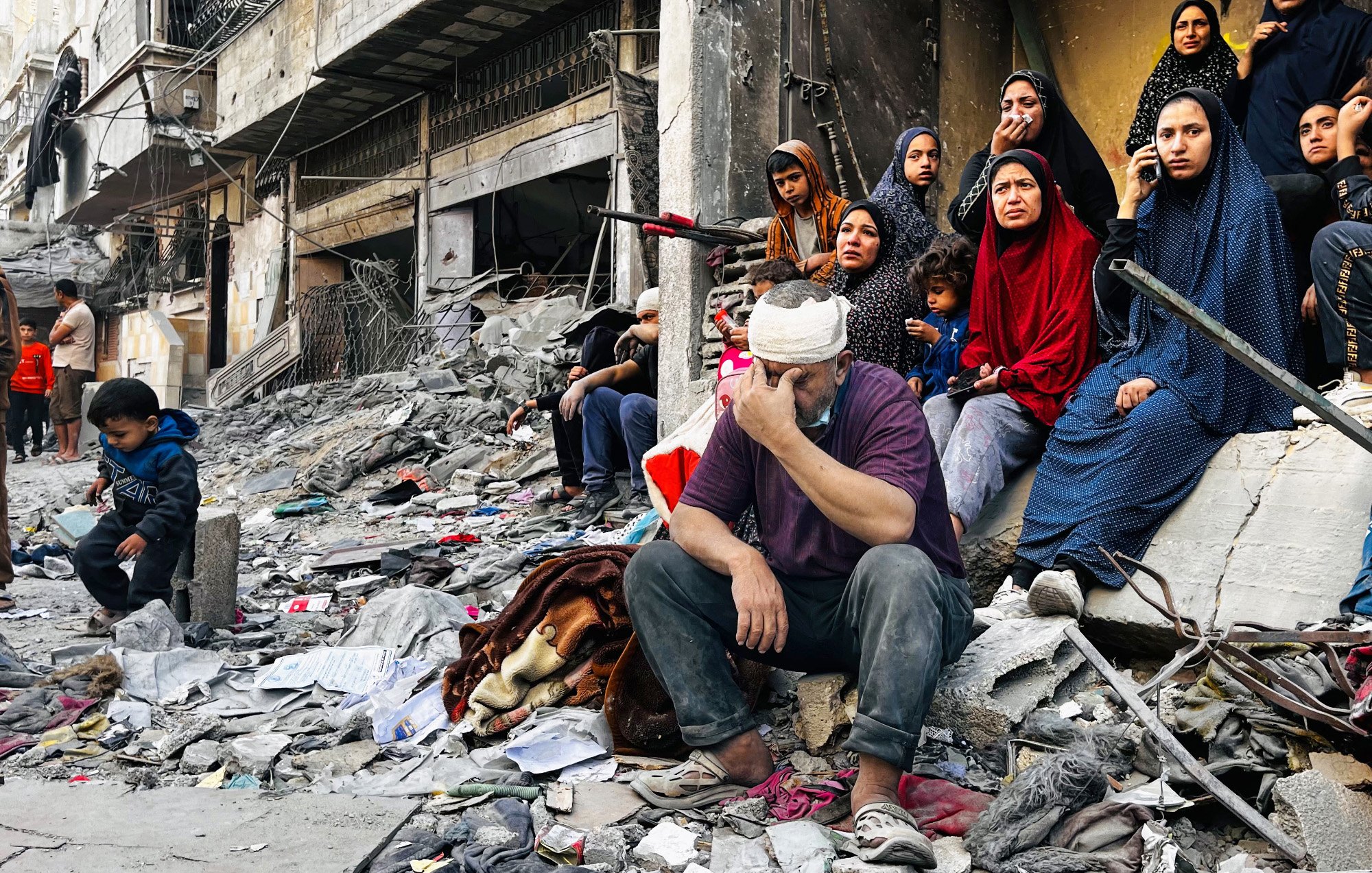 L'immagine mostra una scena devastante in un contesto di guerra o di crisi. Al centro, un uomo con una benda in testa si siede su un cumulo di macerie, con un'espressione di sofferenza e preoccupazione. Attorno a lui, un gruppo di donne sono sedute, vestite con abiti scuri e coprenti, che osservano la scena con sguardi tristi e rassegnati. Un bambino è visibile sulla sinistra, anche lui seduto tra i detriti. Il paesaggio è caratterizzato da edifici distrutti e spazzatura sparsa, evidenziando la desolazione e la disperazione della situazione.