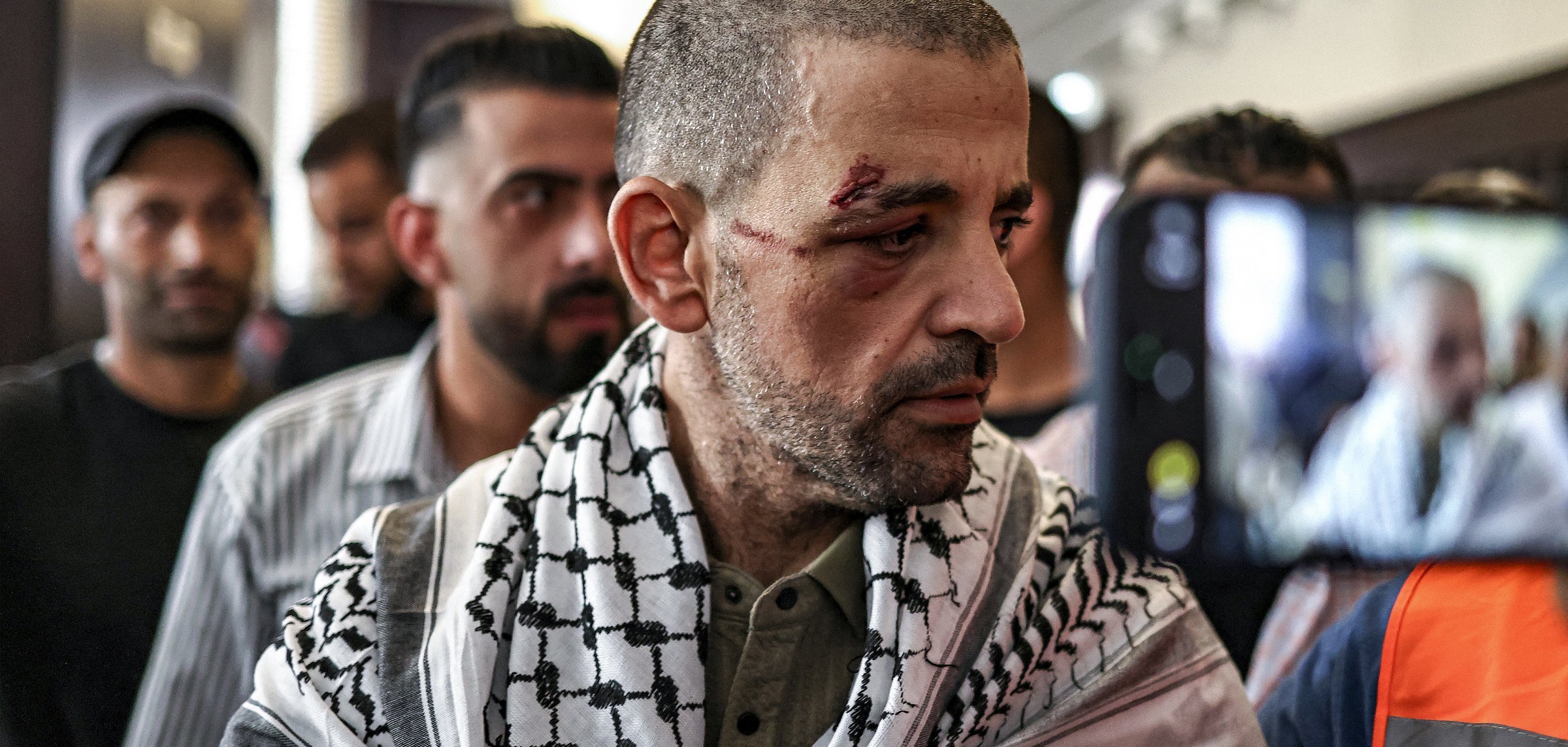 Homme blessé, portant un keffieh, entouré de personnes, visage marqué par une blessure.