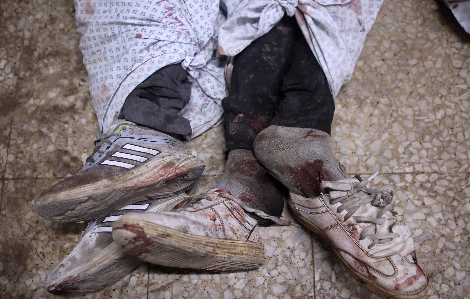 Due paia di scarpe sporche di sangue, avvolte in lenzuola macchiate.