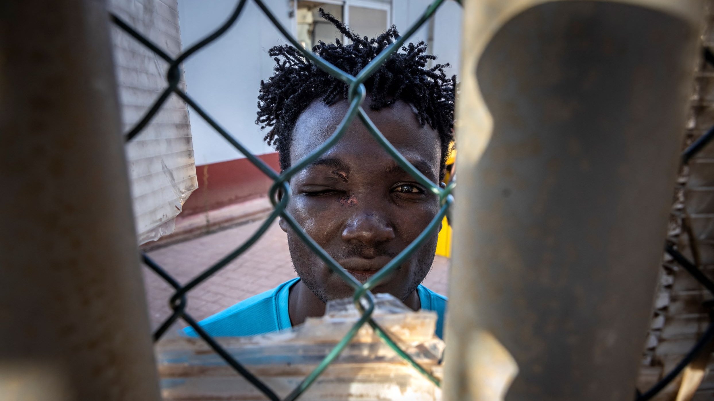 L'image montre un jeune homme regardant à travers un grillage. Son visage est en partie obscurci par le filet, et il semble avoir un œil légèrement gonflé. Il porte un t-shirt bleu et son expression est sérieuse. La lumière met en avant les détails de son visage et des textures du grillage. On ressent une certaine intensité dans son regard.