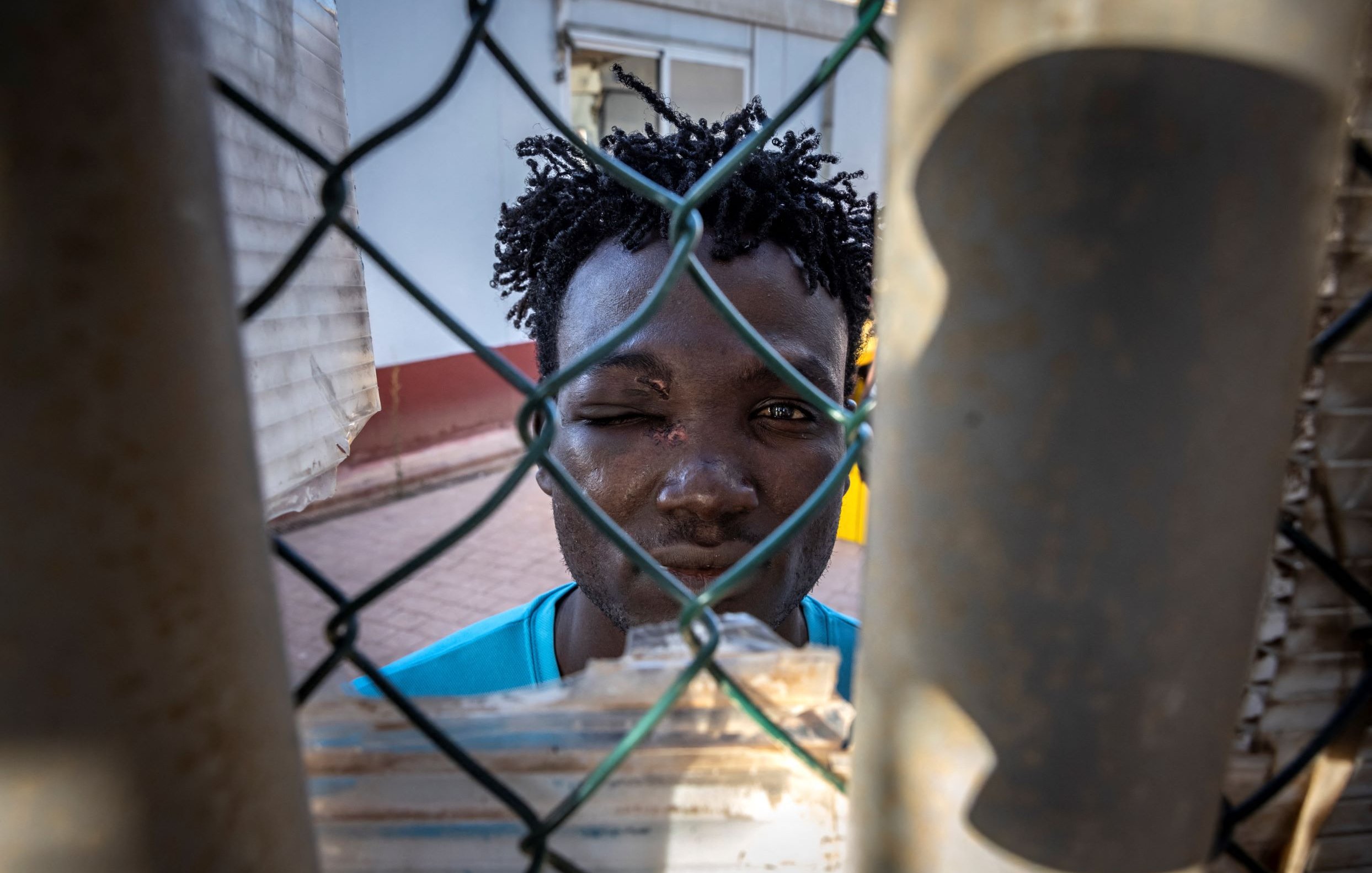 L'image montre un jeune homme regardant à travers un grillage. Son visage est en partie obscurci par le filet, et il semble avoir un œil légèrement gonflé. Il porte un t-shirt bleu et son expression est sérieuse. La lumière met en avant les détails de son visage et des textures du grillage. On ressent une certaine intensité dans son regard.
