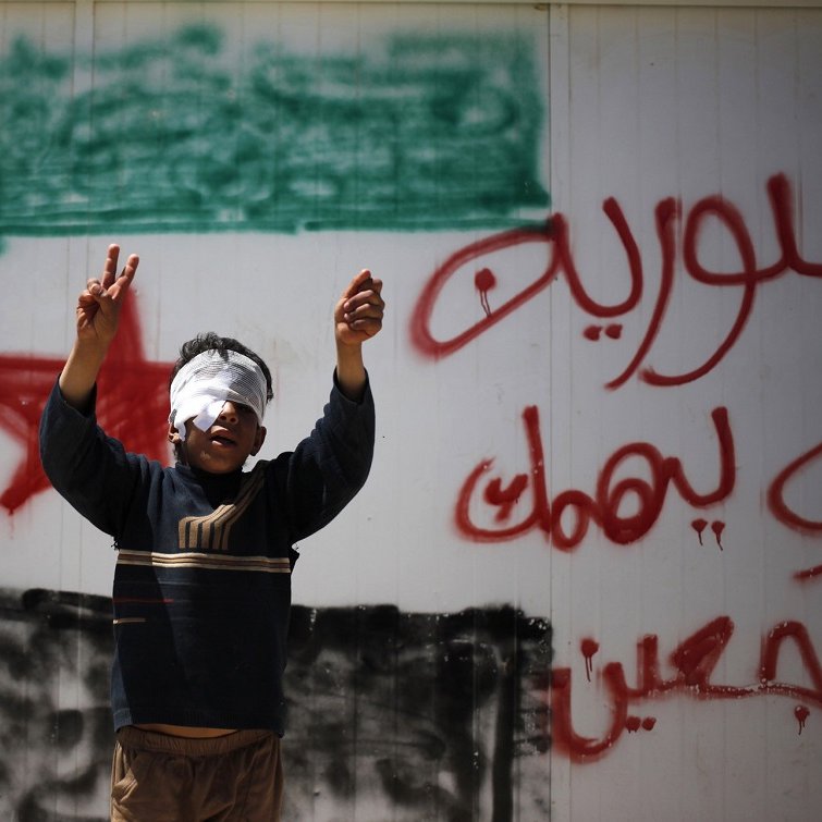 تظهر الصورة صبيًا صغيرًا يرفع يديه بإشارات النصر، بينما يغطّي عينيه برباط أبيض. خلفه جدار مطلي عليه رسم يمثل علم سوريا، مع كلمات مكتوبة بالعربية تظهر اعتراضًا أو دعماً لموضوع معين. تعكس الصورة مشاعر الأمل والعزيمة في وجه الصعوبات.