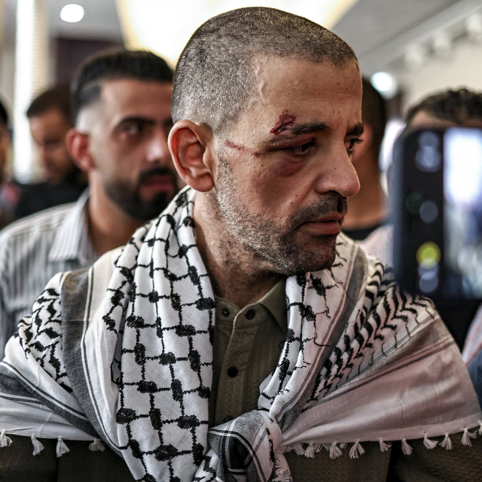 Un uomo con un fazzoletto palestinese, visibilmente colpito, circondato da altre persone.