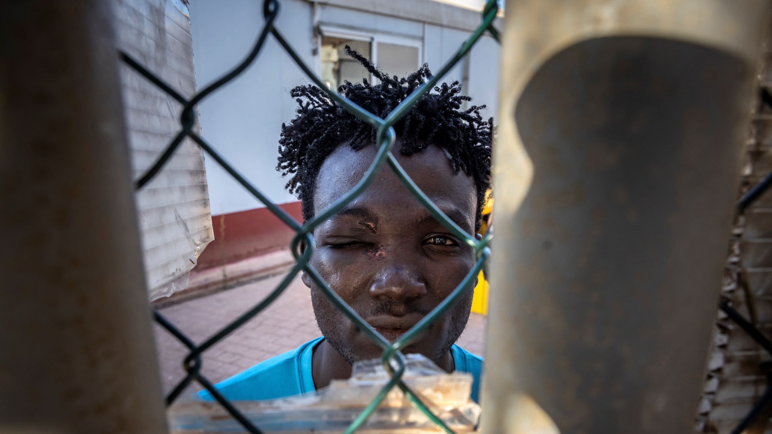 در این تصویر، جوانی با موهای مجعد و تیره در پشت یک حصار مشبک دیده می‌شود. چهره‌اش از طریق شبکه‌های فلزی حصار قابل مشاهده است و به نظر می‌رسد که یکی از چشمانش کمی متورم است. جوان در یک محیط شهری قرار دارد و لباس آبی روشنی به تن دارد. احساسات او در چهره‌اش مشهود است و فضای تصویر با نور طبیعی روشن شده است.