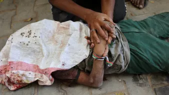 Un bambino ferito, giace a terra, mentre un adulto lo sostiene con affetto.