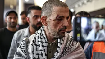 Homme blessé, portant un keffieh, entouré de personnes, visage marqué par une blessure.