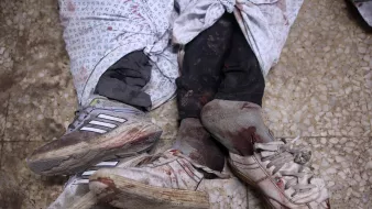 Two pairs of blood-stained shoes are visible, partially covered by tattered cloth.