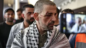 Un uomo con un fazzoletto palestinese, visibilmente colpito, circondato da altre persone.