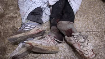 Deux pieds ensanglantés portant des chaussures, enveloppés dans des draps.