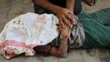 Un bambino ferito, giace a terra, mentre un adulto lo sostiene con affetto.
