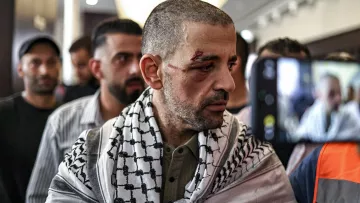 Homme blessé, portant un keffieh, entouré de personnes, visage marqué par une blessure.