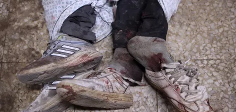 Deux pieds ensanglantés portant des chaussures, enveloppés dans des draps.